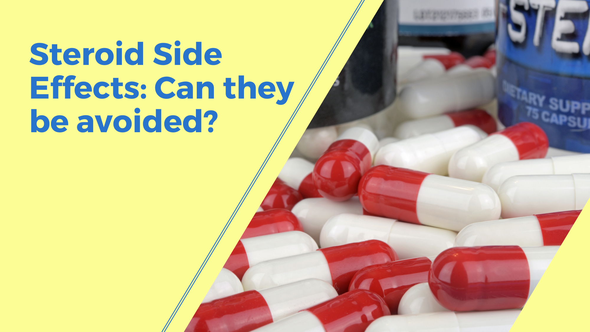 Steroid Side Effects Can they be avoided?